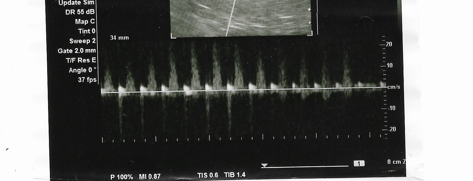 Scan of ultrasound printout