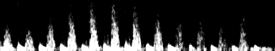 Top half of scanned ultrasound image